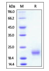 Rat GITR, His Tag on SDS-PAGE under reducing (R) condition. The gel was stained overnight with Coomassie Blue. The purity of the protein is greater than 95%.